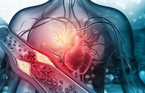 Heart & Vascular Center